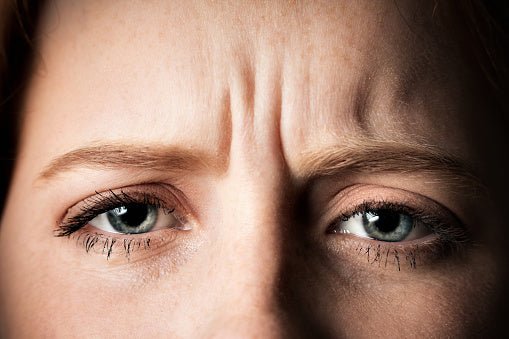 How Can We Reduce Frown Lines? Lunaescent is the Perfect All Natural, Injection-Free Solution!