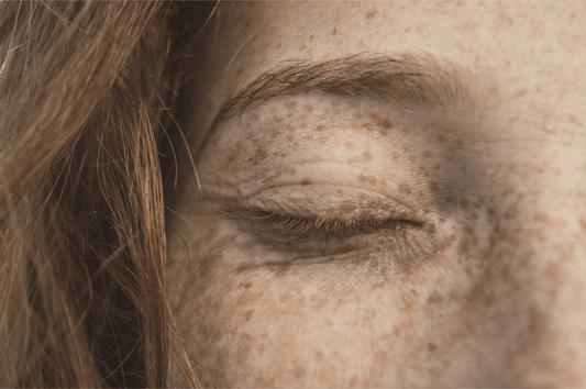 Skin Microbiome and its Effect on Skin Health