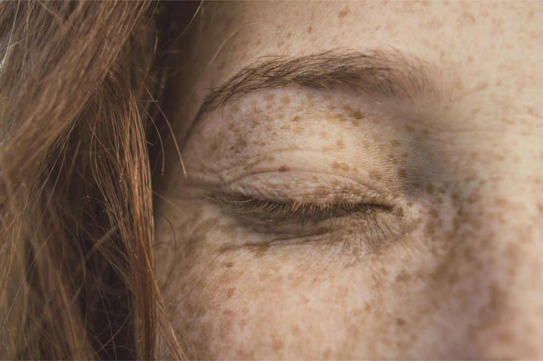 Skin Microbiome and its Effect on Skin Health
